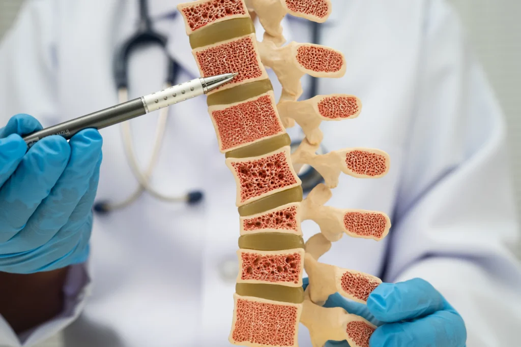 medical professional examining spinal model in cli 2026 03 19 23 28 43 utc